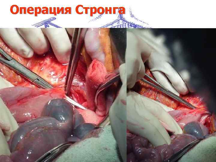 Операция Стронга 