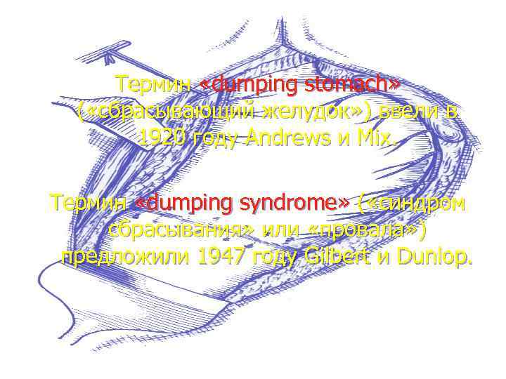 Термин «dumping stomach» ( «сбрасывающий желудок» ) ввели в 1920 году Andrews и Mix.