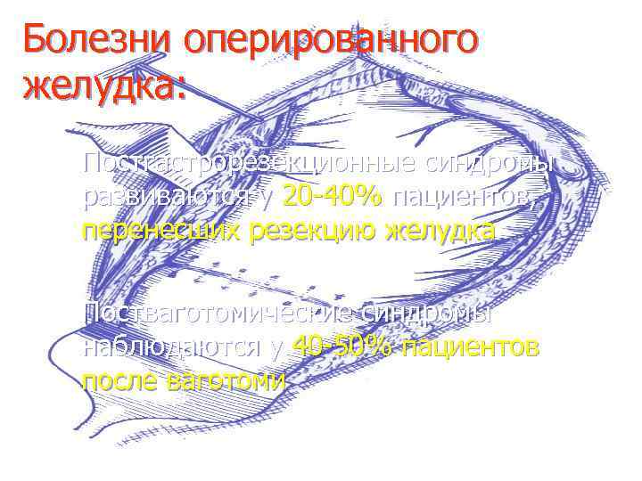 Болезни оперированного желудка: Постгастрорезекционные синдромы развиваются у 20 -40% пациентов, перенесших резекцию желудка Постваготомические