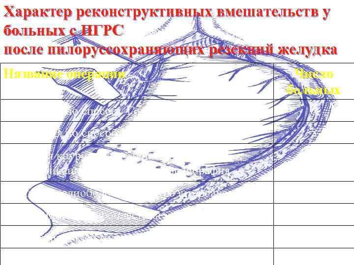Характер реконструктивных вмешательств у больных с ПГРС после пилоруссохраняющих резекций желудка Название операции Число