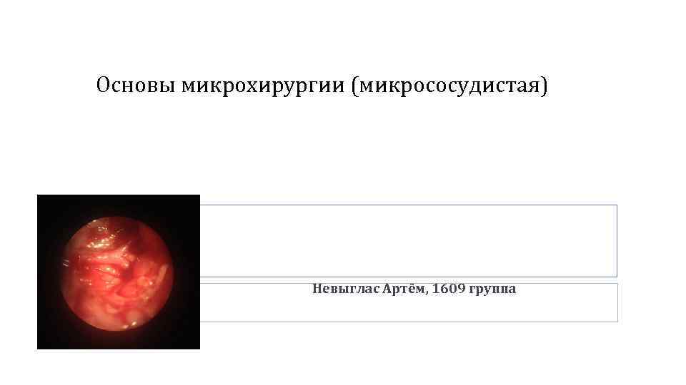 Основы микрохирургии (микрососудистая) Невыглас Артём, 1609 группа 