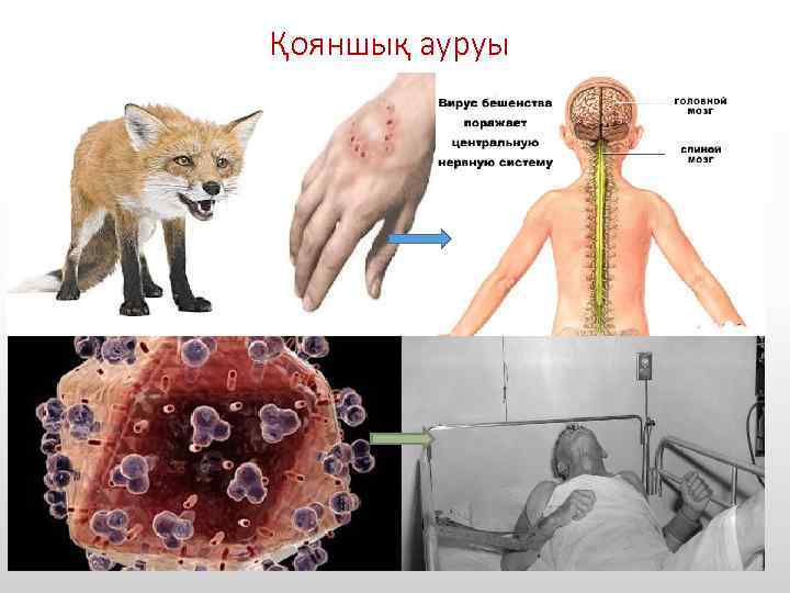 Қояншық ауруы 