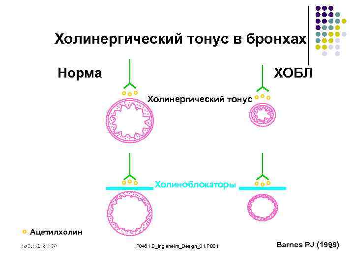 Холинергический тонус в бронхах Норма ХОБЛ Холинергический тонус Холиноблокаторы Ацетилхолин Сопротивление µ 1/радиус4 18.