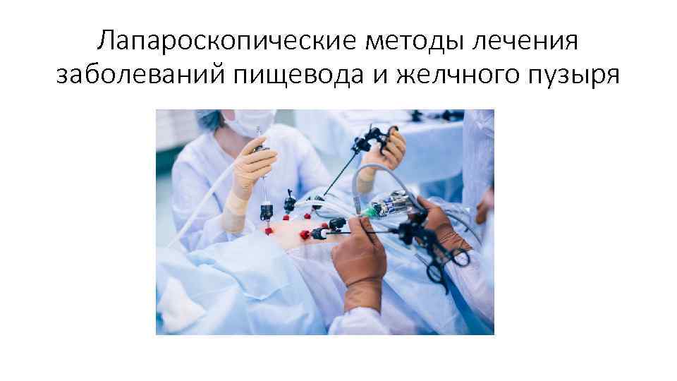 Лапароскопические методы лечения заболеваний пищевода и желчного пузыря 