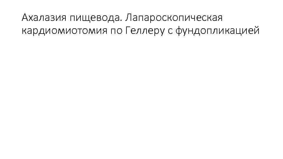 Ахалазия пищевода. Лапароскопическая кардиомиотомия по Геллеру с фундопликацией 