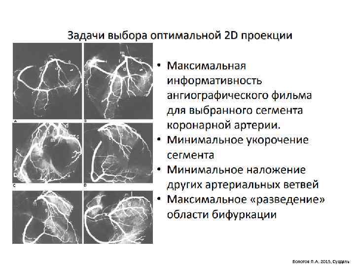 Болотов П. А. 2015, Суздаль 
