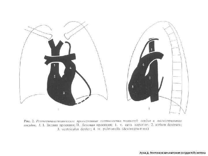 Лужа Д. Рентгеновская анатомия сосудистой системы 