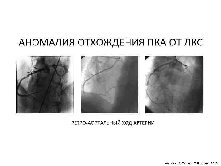 Азаров А. В. , Семитко С. П. и соавт. 2014 