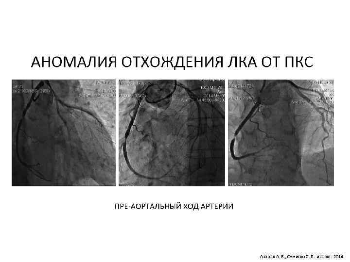 Азаров А. В. , Семитко С. П. и соавт. 2014 