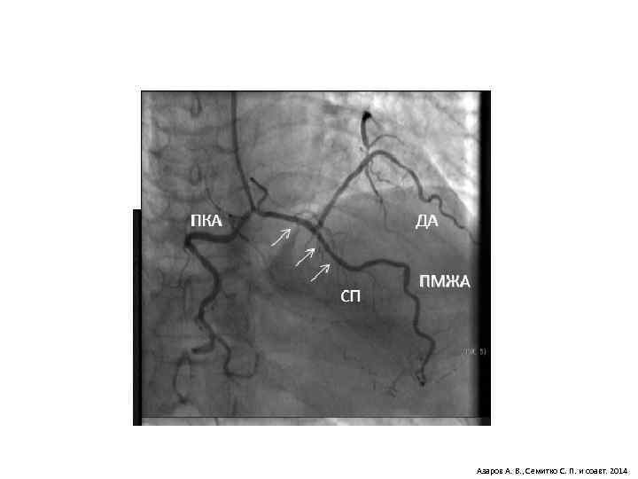 Азаров А. В. , Семитко С. П. и соавт. 2014 