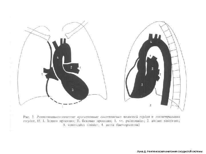 Лужа Д. Рентгеновская анатомия сосудистой системы 