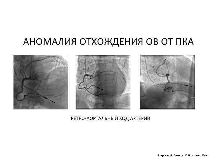 Азаров А. В. , Семитко С. П. и соавт. 2014 