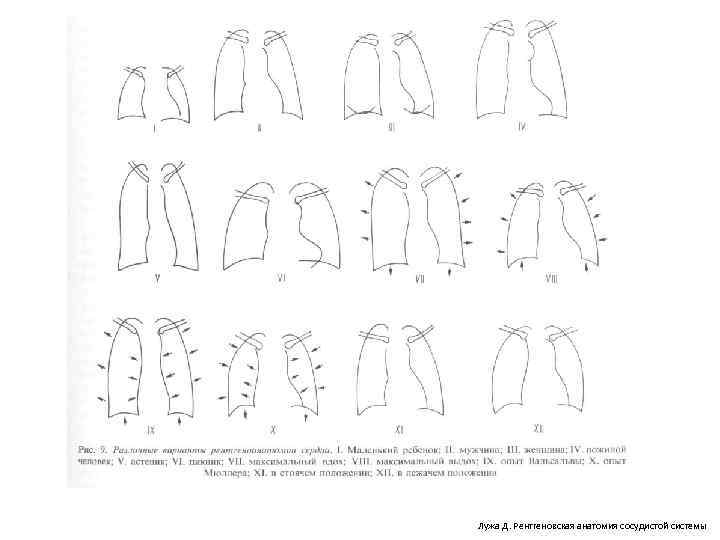 Лужа Д. Рентгеновская анатомия сосудистой системы 