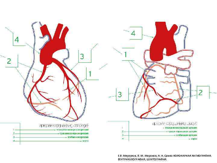 Е. В. Меркулов, В. М. Миронов, А. Н. Самко КОРОНАРНАЯ АНГИОГРАФИЯ, ВЕНТРИКУЛОГРАФИЯ, ШУНТОГРАФИЯ. 
