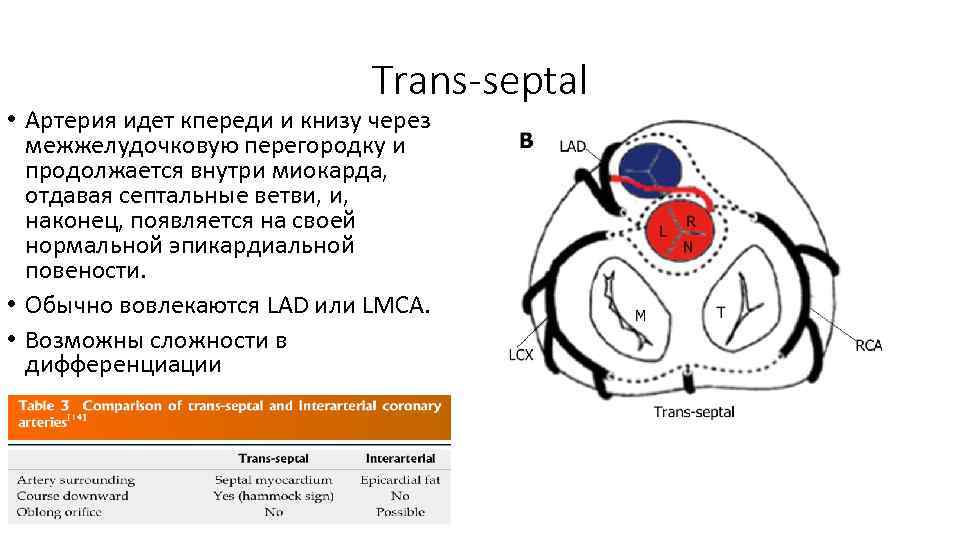 Trans-septal • Артерия идет кпереди и книзу через межжелудочковую перегородку и продолжается внутри миокарда,