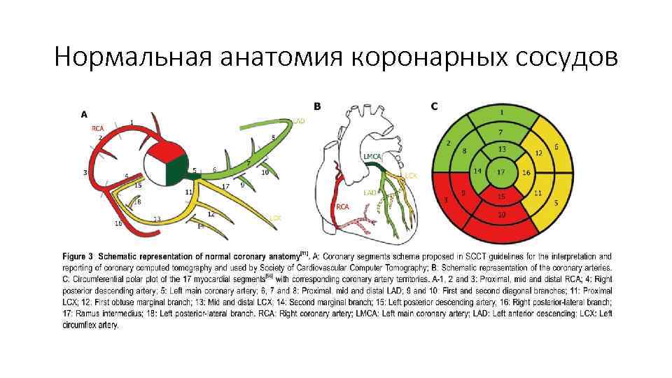 Коронарные артерии анатомия схема