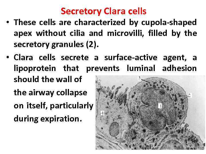 Secretory Clara cells • These cells are characterized by cupola-shaped apex without cilia and