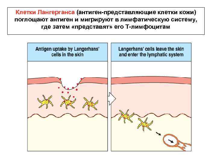 Клетки Лангерганса (антиген-представляющие клетки кожи) поглощают антиген и мигрируют в лимфатическую систему, где затем