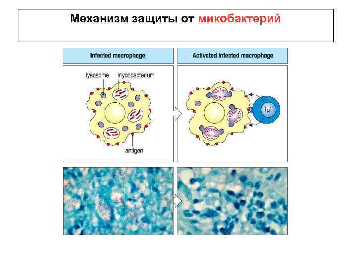 Механизм защиты от микобактерий 