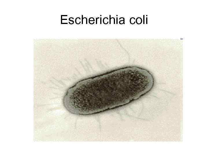 Escherichia coli 