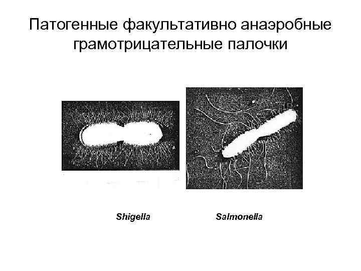Патогенные факультативно анаэробные грамотрицательные палочки Shigella Salmonella 