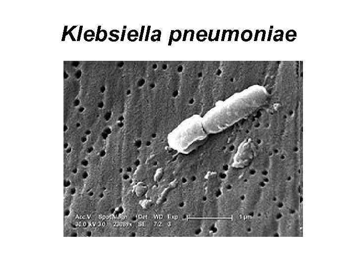 Klebsiella pneumoniae 