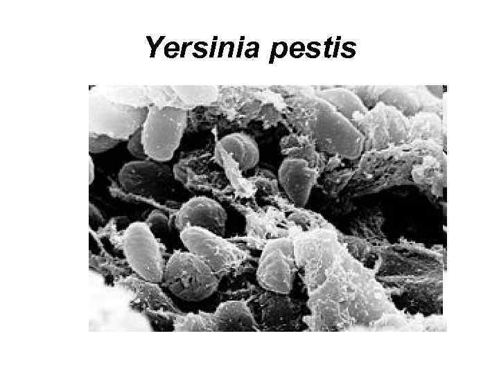 Yersinia pestis 