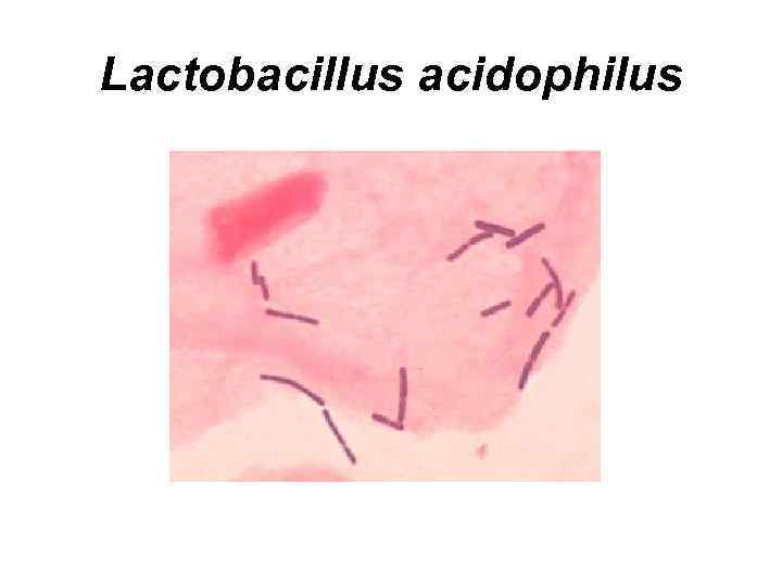 Lactobacillus acidophilus 