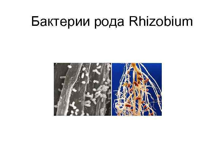 Роды бактерий. Бактерии рода Rhizobium. Пигмент бактерии рода Rhizobium:. Бактерии Rhizobium комментариями. Rhizobium phaseoli под микроскопом.