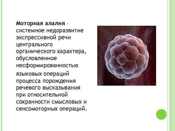 Речевая симптоматика моторной алалии