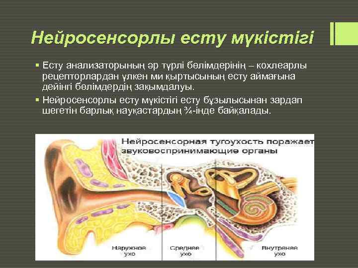 Нейросенсорлы есту мүкістігі § Есту анализаторының әр түрлі бөлімдерінің – кохлеарлы рецепторлардан үлкен ми