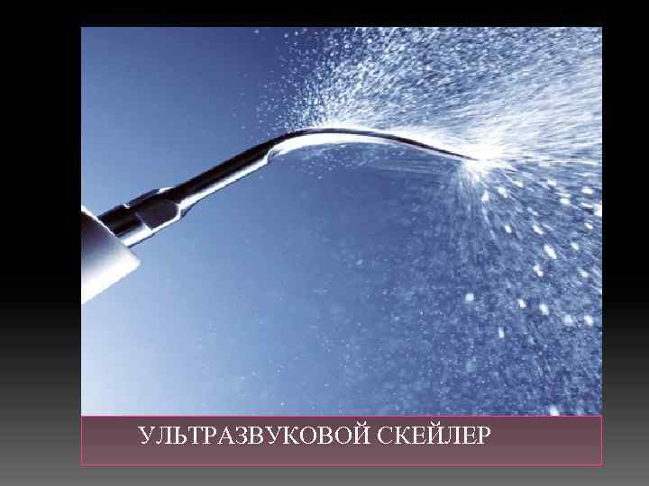  УЛЬТРАЗВУКОВОЙ СКЕЙЛЕР 