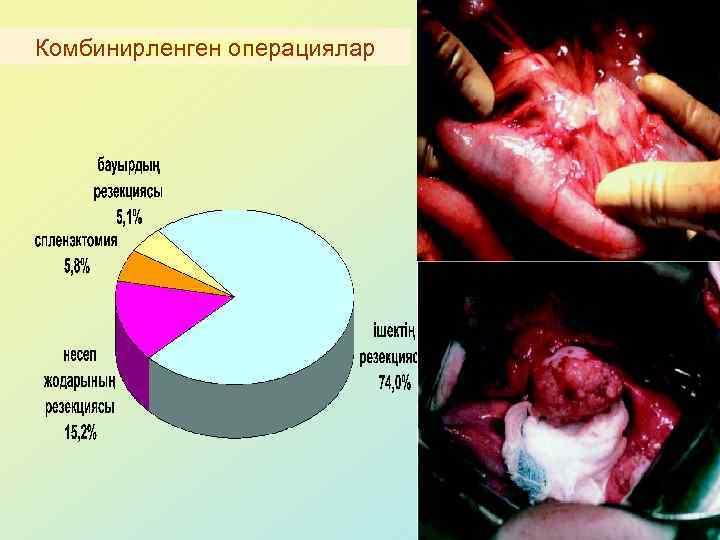 Комбинирленген операциялар 