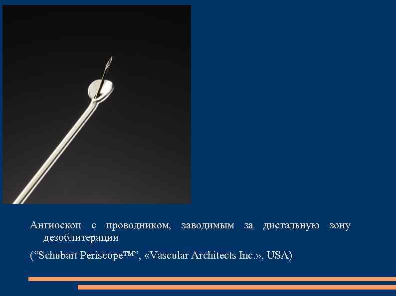 Ангиоскоп с проводником, заводимым за дистальную зону дезоблитерации (“Schubart Periscope™”, «Vascular Architects Inc. »