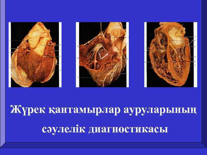 Жүрек қантамырлар ауруларының сәулелік диагностикасы 