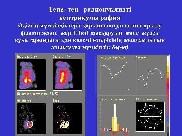 Тепе- тең радионуклидті вентрикулография Әдістің мүмкіндіктері: қарыншалардың шығарылу фракциясын, жергілікті қысқаруын және жүрек қуыстарындағы