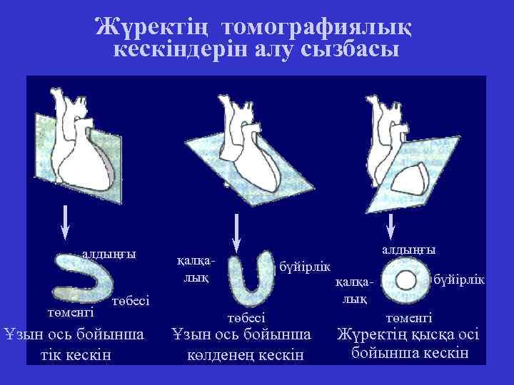 Жүректің томографиялық кескіндерін алу сызбасы алдыңғы төменгі алдыңғы қалқалық бүйірлік төбесі Ұзын ось бойынша
