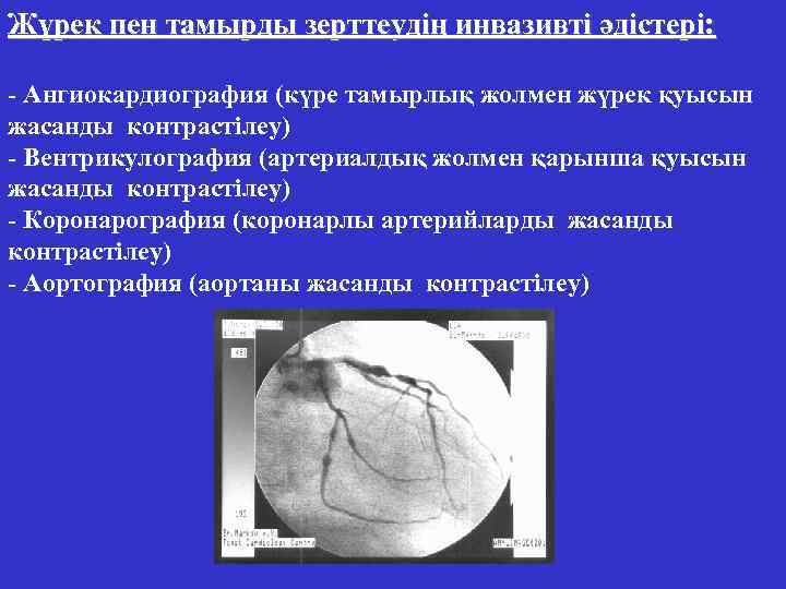 Жүрек пен тамырды зерттеудің инвазивті әдістері: - Ангиокардиография (күре тамырлық жолмен жүрек қуысын жасанды