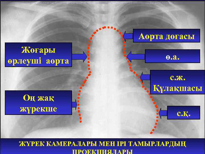 Аорта доғасы Жоғары өрлеуші аорта Оң жақ жүрекше ө. а. с. ж. Құлақшасы с.