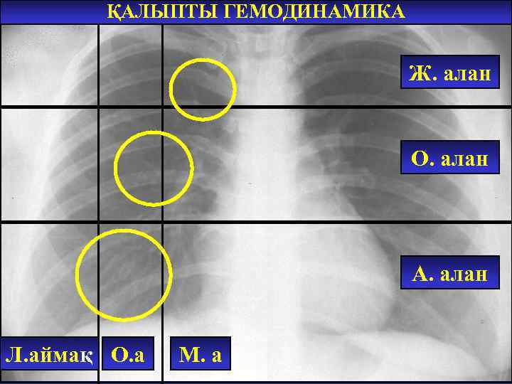 ҚАЛЫПТЫ ГЕМОДИНАМИКА Ж. алан О. алан А. алан Л. аймақ О. а М. а