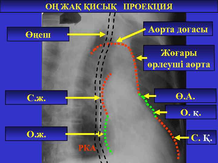 ОҢ ЖАҚ ҚИСЫҚ ПРОЕКЦИЯ Аорта доғасы Өңеш Жоғары өрлеуші аорта Ө. А. С. ж.