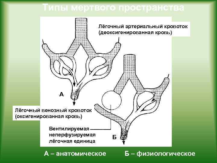 Типы мертвого пространства Лёгочный артериальный кровоток (деоксигенированная кровь) А Лёгочный венозный кровоток (оксигенированная кровь)