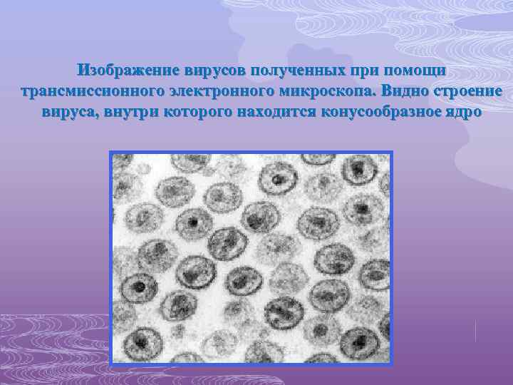 Изображение вирусов полученных при помощи трансмиссионного электронного микроскопа. Видно строение вируса, внутри которого находится