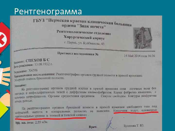 Рентгенограмма 