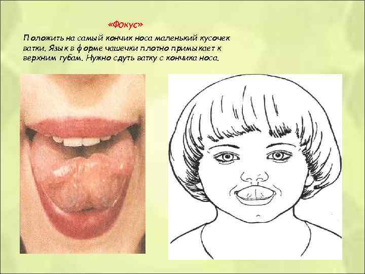  «Фокус» Положить на самый кончик носа маленький кусочек ватки. Язык в форме чашечки