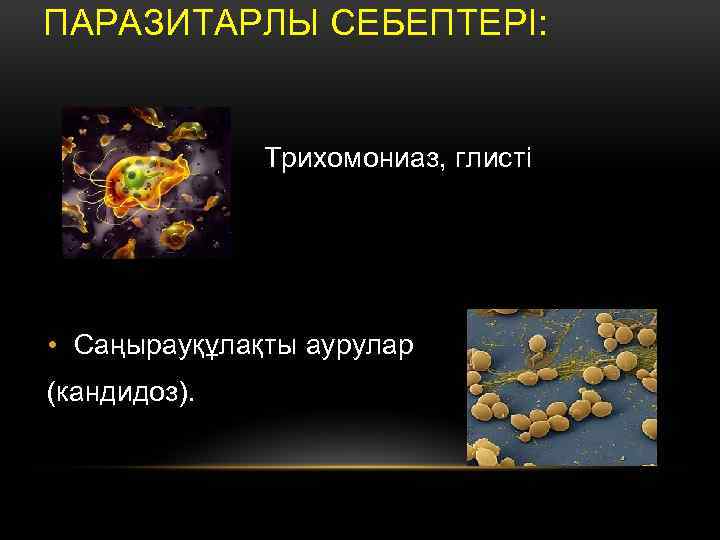 ПАРАЗИТАРЛЫ СЕБЕПТЕРІ: Трихомониаз, глисті инвазия • Саңырауқұлақты аурулар (кандидоз). 