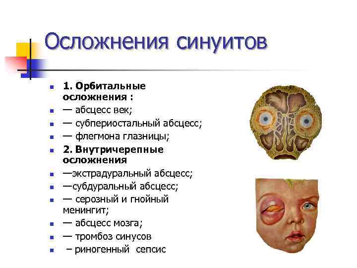 Осложнения синуитов n n n 1. Орбитальные осложнения : — абсцесс век; — субпериостальный