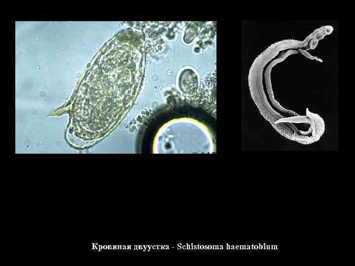 Кровяная двуустка - Schistosoma haematobium 