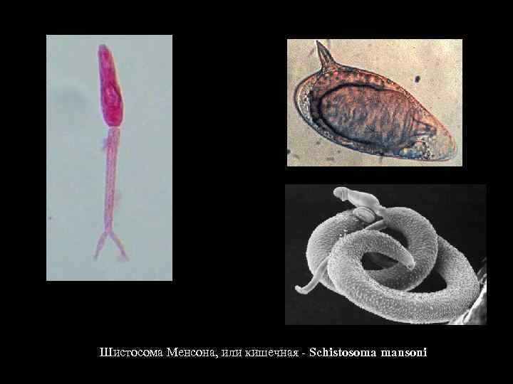 Шистосома Менсона, или кишечная - Schistosoma mansoni 