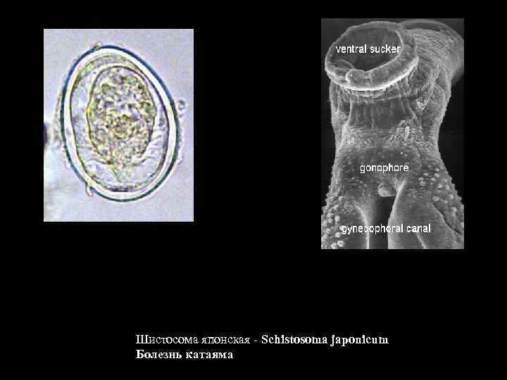 Шистосома японская - Schistosoma japonicum Болезнь катаяма 
